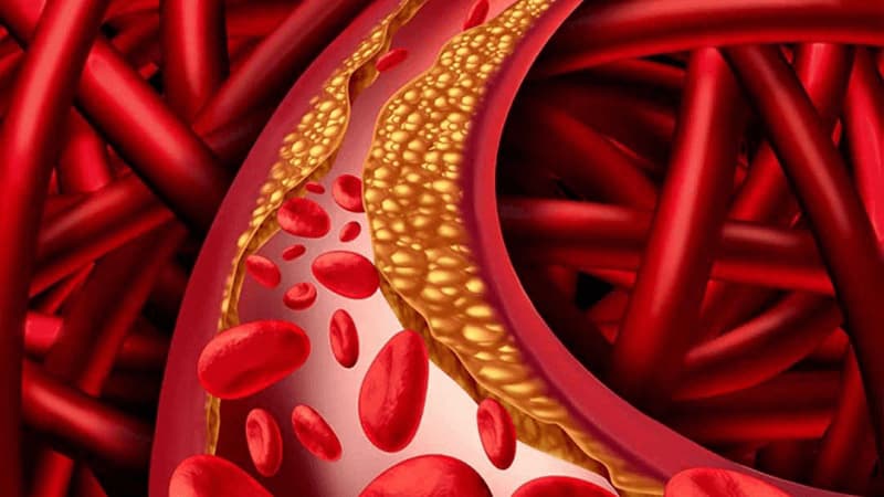 Tắc nghẽn mạch máu gây ra nhiều tác hại.