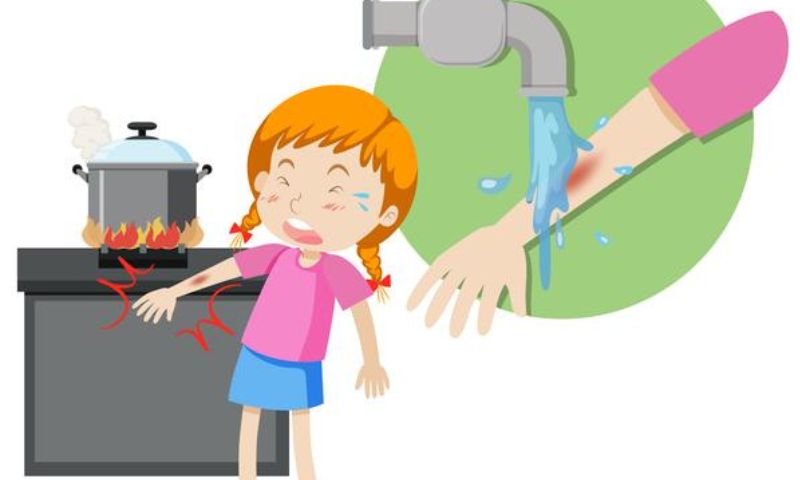 Xử trí ban đầu khi trẻ bị bỏng do nhiệt, do lửa - Cách chữa trị trẻ bị bỏng (Nguồn: Sưu tầm Internet)