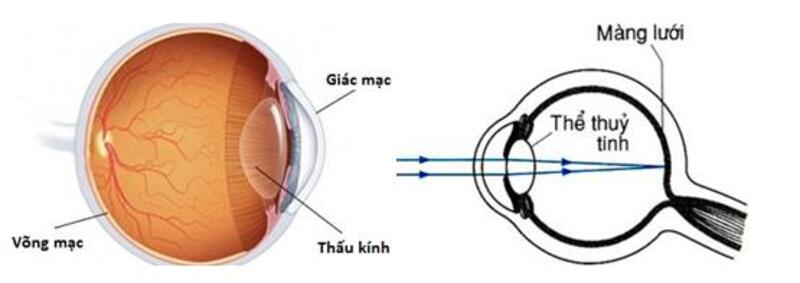 Hai bộ phận chính của mắt là màng lưới và thể thủy tinh. (Ảnh: Sưu tầm Internet)