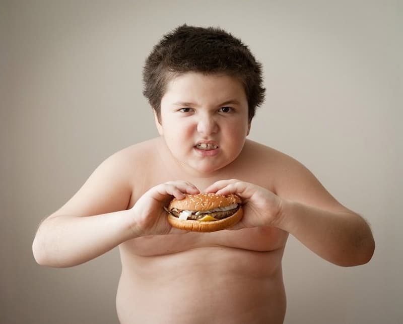 Ảnh hưởng của bệnh béo phì đối với sức khỏe của trẻ.  (Ảnh: sưu tầm internet)