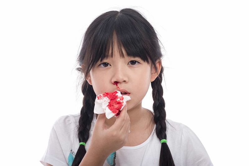 Một số bệnh lý có thể liên quan đến tình trạng chảy máu mũi. (Ảnh: Sưu tầm Internet)