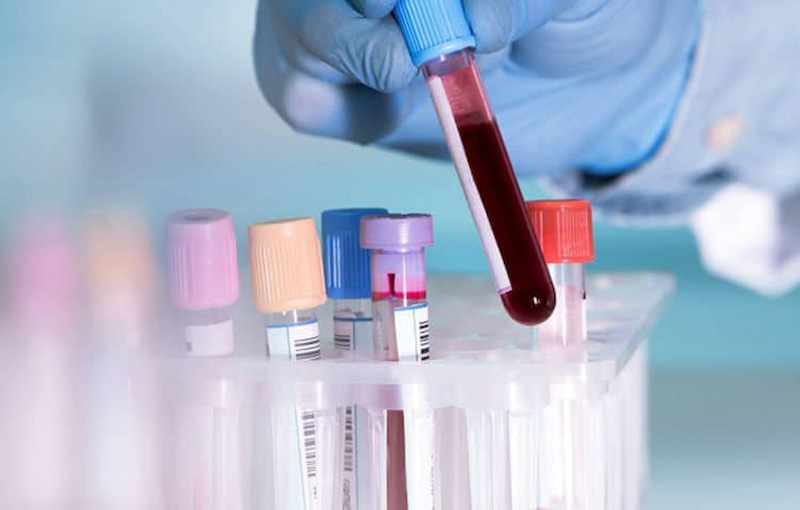 Xét nghiệm máu thường xuyên là cách dễ dàng nhất để xác định bạn thiếu vi chất nào hay không. (Ảnh: Sưu tầm Internet)