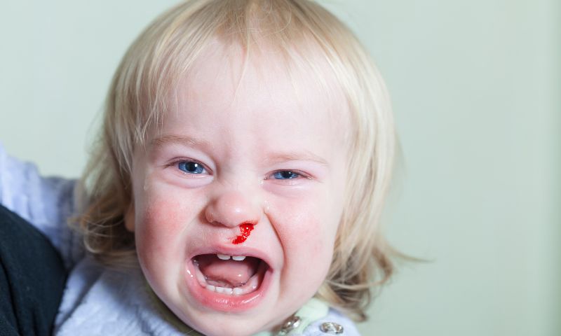 Trẻ 1 tuổi bị chảy máu cam có nguy hiểm không? (Ảnh: Nguồn Internet)
