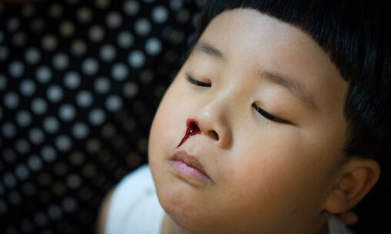 Trẻ 3 tuổi bị chảy máu cam có nguy hiểm hay không. (Ảnh: Nguồn Internet)