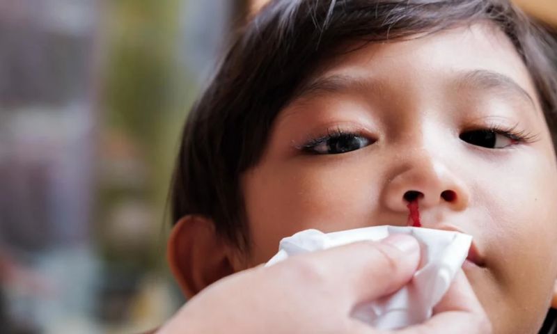 Phòng ngừa nguy cơ chảy máu cam ở trẻ. (Ảnh: Nguồn Internet)
