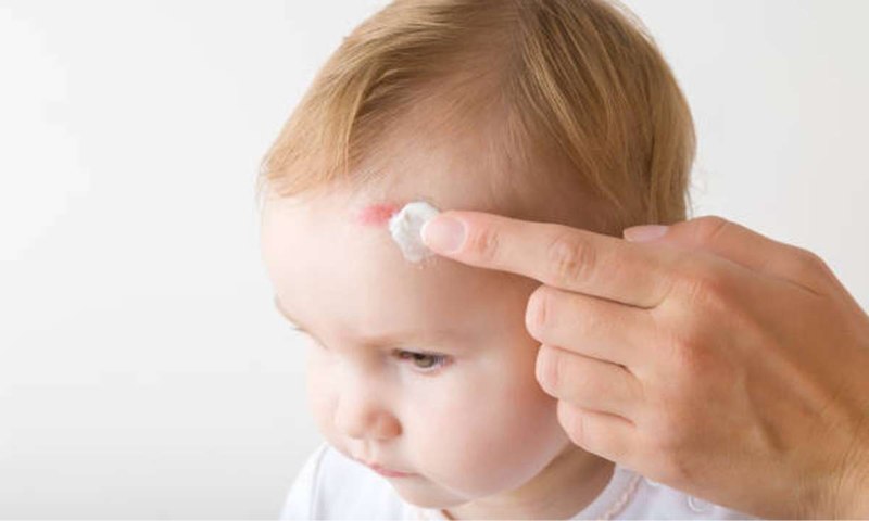 Hướng dẫn xử lý trong trường hợp trẻ bị chấn động nhẹ (Nguồn: Sưu tầm Internet)