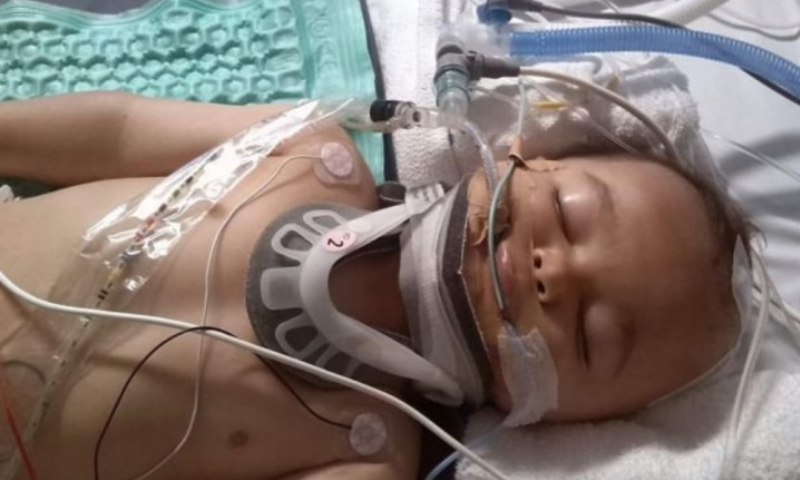 Đưa trẻ đến bệnh viện khi trẻ 6 tháng tuổi bị ngã đập đầu và có những dấu hiệu nào? (Nguồn: Sưu tầm Internet)