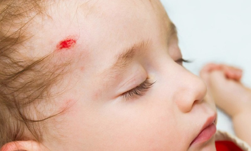 Nguyên nhân trẻ 6 tuổi bị ngã đập đầu xuống đất (Nguồn: Sưu tầm Internet)