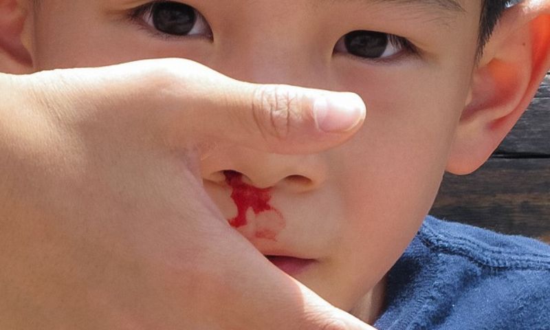 Chảy máu mũi sau ít xảy ra tuy nhiên chúng lại nguy hiểm hơn nhiều. (Ảnh: Nguồn Internet)