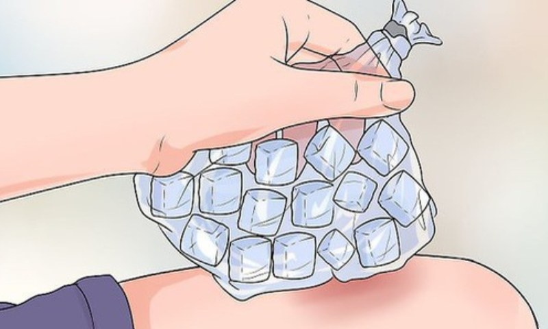 Sử dụng đá hoặc khăn lạnh chườm lên vết thương giúp giảm bầm tím hiệu quả (Nguồn: Sưu tầm Internet)