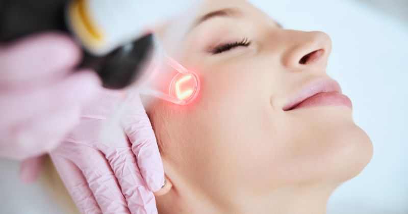 Quy trình thực hiện điều trị rạn da bằng tia laser (Ảnh: Sưu tầm Internet)