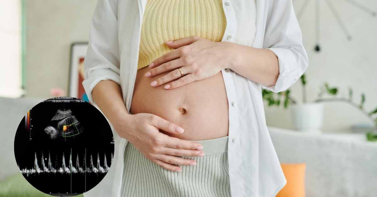 Mang thai 10 tuần mới có tim thai có sao không và những điều cần lưu ý?