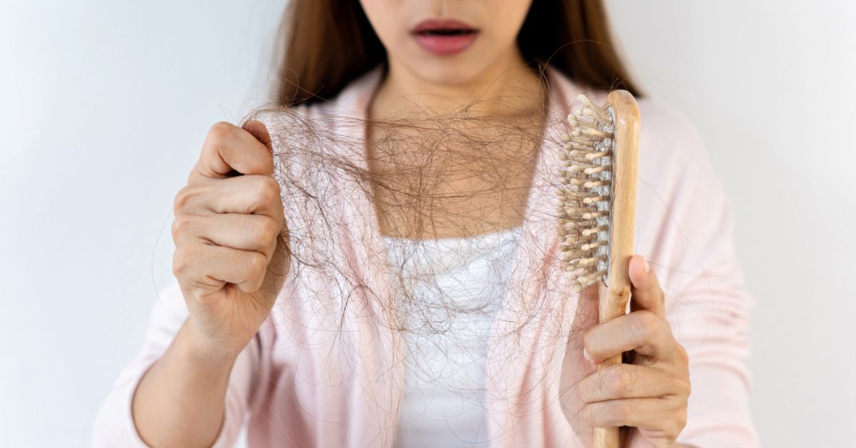 Nguyên nhân gây rụng tóc sau sinh và 3+ Bí kíp chữa trị hiệu quả