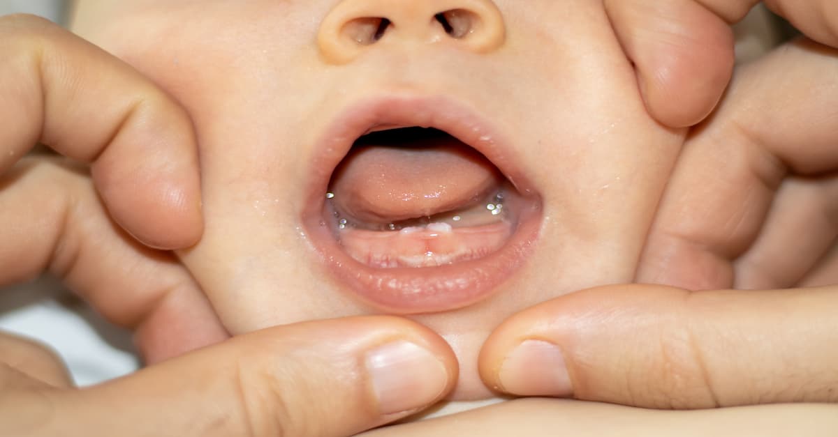 Trẻ 11 tháng chưa mọc răng có phải mọc răng chậm: Chuyên gia giải đáp
