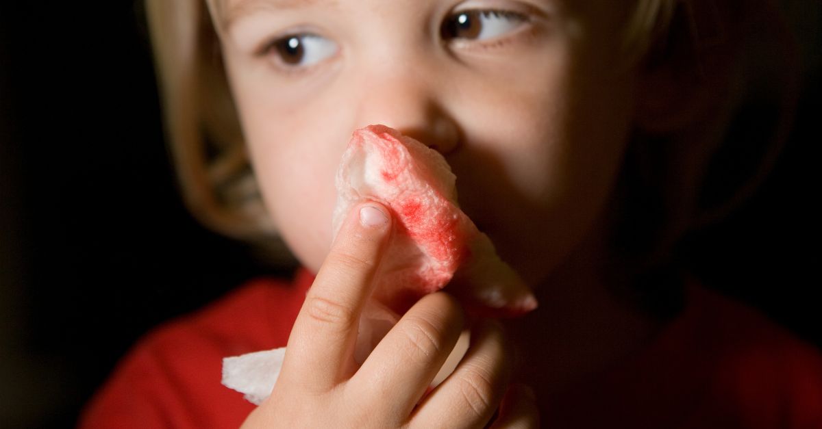 Trẻ con bị ngã chảy máu mũi có sao không?- Lời khuyên từ chuyên gia